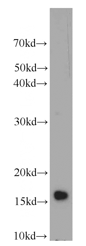 mouse testis tissue were subjected to SDS PAGE followed by western blot with Catalog No:111676(IGF1A-Specific antibody) at dilution of 1:500