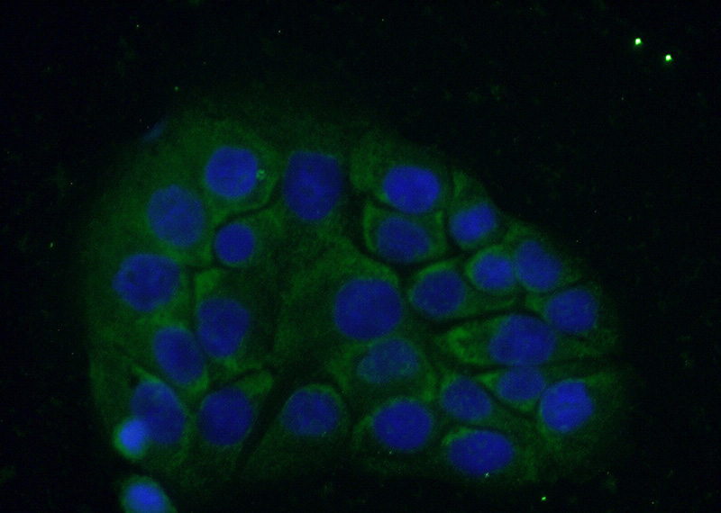 Immunofluorescent analysis of (-20oc Ethanol) fixed COLO 320 cells using Catalog No:108614(C18orf21 Antibody) at dilution of 1:50 and Alexa Fluor 488-congugated AffiniPure Goat Anti-Rabbit IgG(H+L)