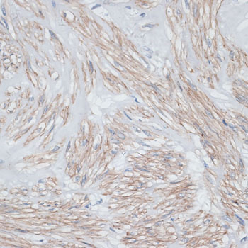 Immunohistochemistry - TPM1 Polyclonal Antibody 