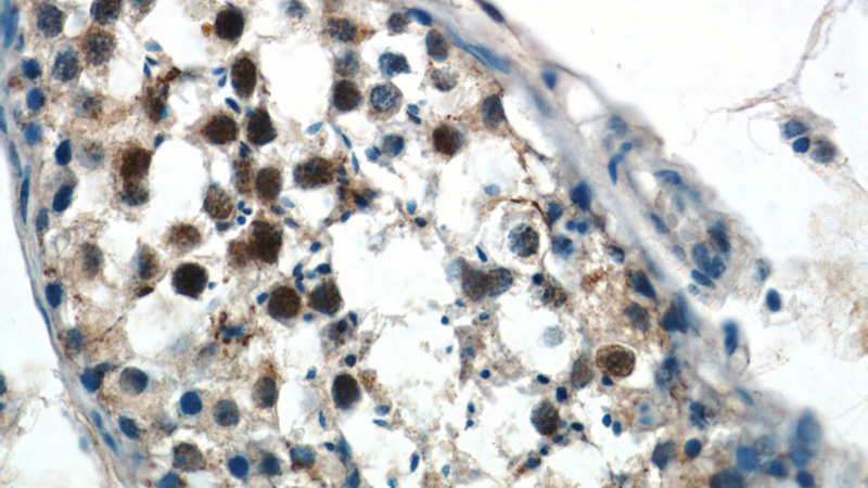 Immunohistochemistry of paraffin-embedded human testis tissue slide using Catalog No:109660(CCNA1 Antibody) at dilution of 1:50 (under 40x lens)