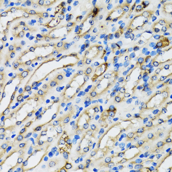 Immunohistochemistry - COPB2 Polyclonal Antibody 