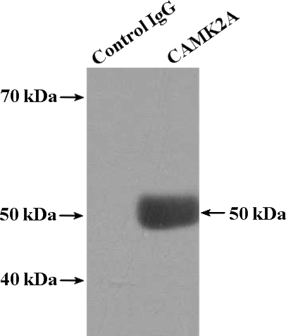 IP Result of anti-CAMK2A-Specific (IP:Catalog No:108915, 4ug; Detection:Catalog No:108915 1:1000) with HEK-293 cells lysate 1480ug.