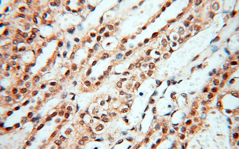 Immunohistochemical of paraffin-embedded human kidney using Catalog No:116593(USP16 antibody) at dilution of 1:100 (under 40x lens)