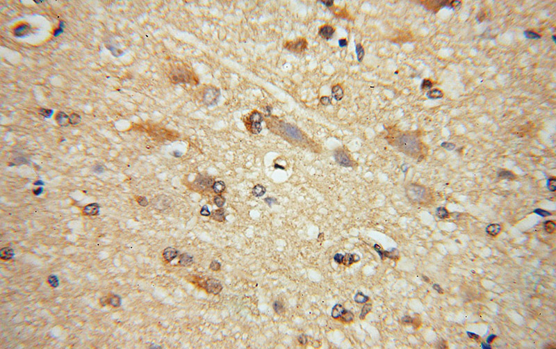 Immunohistochemical of paraffin-embedded human brain using Catalog No:111210(GRIPAP1 antibody) at dilution of 1:50 (under 40x lens)