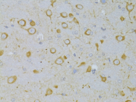 Immunohistochemistry - TSHR Polyclonal Antibody 