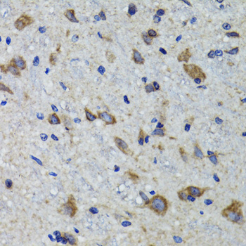 Immunohistochemistry - HEXA Polyclonal Antibody 