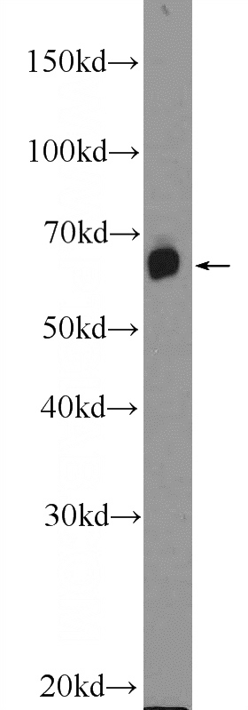 mouse brain tissue were subjected to SDS PAGE followed by western blot with Catalog No:110849(GALNT9 Antibody) at dilution of 1:1000