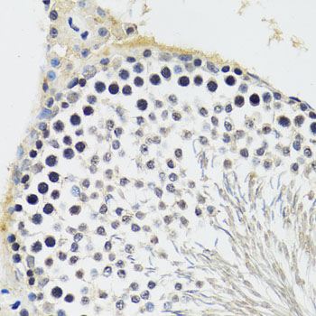 Immunohistochemistry - CREBBP Polyclonal Antibody 