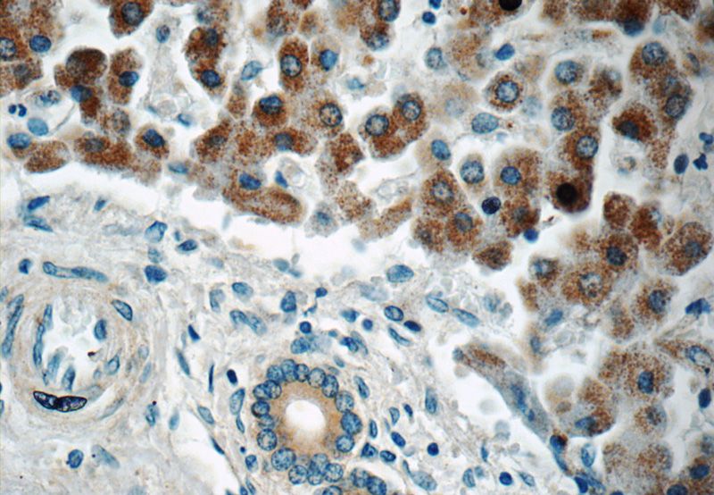 Immunohistochemistry of paraffin-embedded human liver tissue slide using Catalog No:108254(ARFIP2 Antibody) at dilution of 1:50 (under 40x lens)