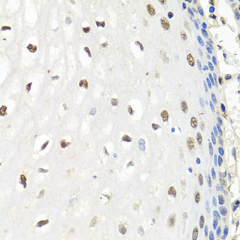 Immunohistochemistry - CNOT8 Polyclonal Antibody 