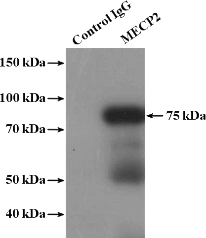IP Result of anti-MECP2 (IP:Catalog No:112577, 4ug; Detection:Catalog No:112577 1:500) with MCF-7 cells lysate 1280ug.