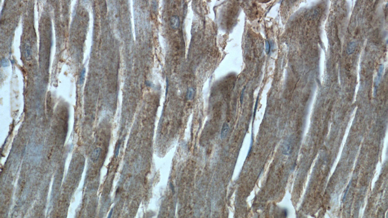 Immunohistochemistry of paraffin-embedded human heart tissue slide using Catalog No:116544(UBE4B Antibody) at dilution of 1:50 (under 40x lens)