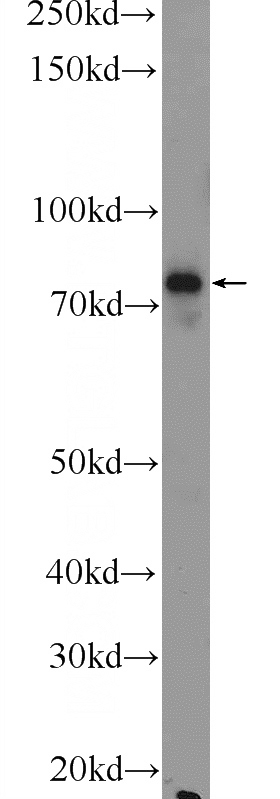 mouse lung tissue were subjected to SDS PAGE followed by western blot with Catalog No:110446(F13A1 Antibody) at dilution of 1:300