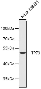 Western blot - TP73 Polyclonal Antibody 