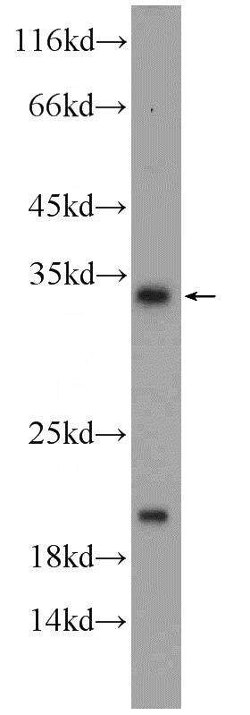 HepG2 cells were subjected to SDS PAGE followed by western blot with Catalog No:114401(QPRT Antibody) at dilution of 1:1000