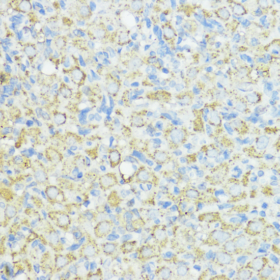 Immunohistochemistry - SOD3 Polyclonal Antibody 