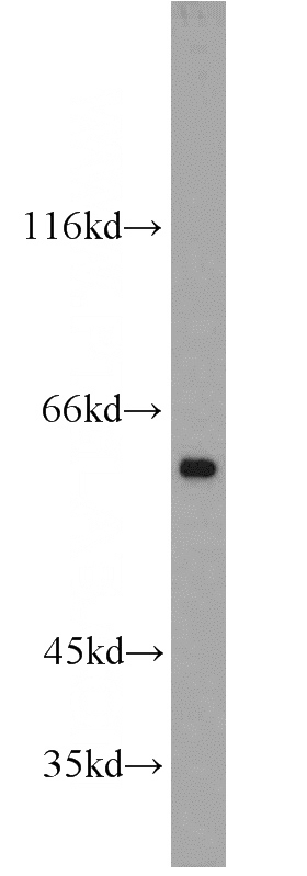 MCF7 cells were subjected to SDS PAGE followed by western blot with Catalog No:113556(SQSTM1 antibody) at dilution of 1:500