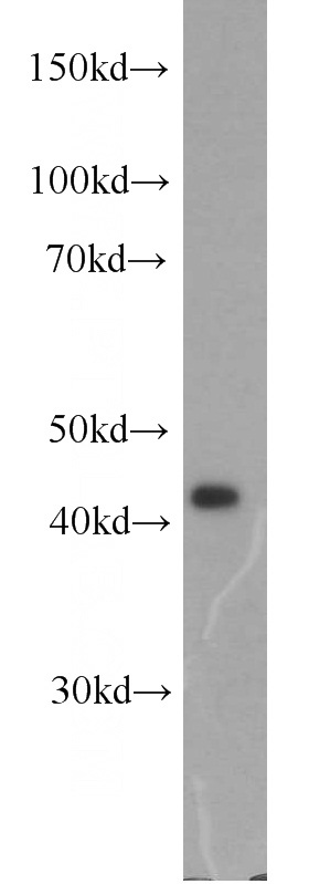 HeLa cells were subjected to SDS PAGE followed by western blot with Catalog No:111604(IDH2 antibody) at dilution of 1:1000