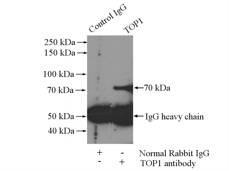 IP Result of anti-TOP1 (IP:Catalog No:116244, 4ug; Detection:Catalog No:116244 1:500) with L02 cells lysate 1800ug.