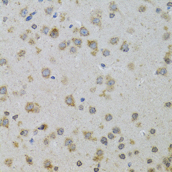 Immunohistochemistry - PDYN Polyclonal Antibody 
