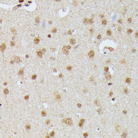 Immunohistochemistry - IGHMBP2 Polyclonal Antibody 