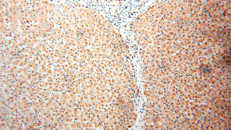 Immunohistochemical of paraffin-embedded human liver using Catalog No:109222(CHDH antibody) at dilution of 1:100 (under 10x lens)