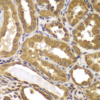 Immunohistochemistry - PSEN2 Polyclonal Antibody 