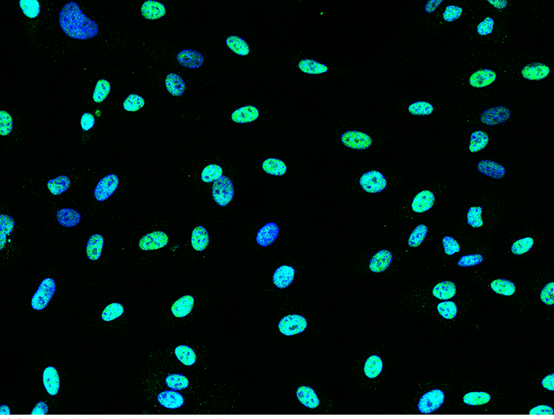 Human NR2F2/COUP-TF II Immunofluorescence(IF) 15411