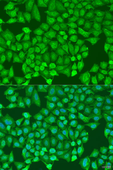 Immunofluorescence - CTCF Polyclonal Antibody 