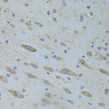 Immunohistochemistry - SARS Polyclonal Antibody 