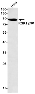 Western blot detection of RSK1 p90 in Hela cell lysates using RSK1 p90 Rabbit mAb(1:500 diluted).Predicted band size:83kDa.Observed band size:90kDa.
