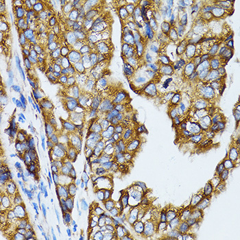 Immunohistochemistry - RPL6 Polyclonal Antibody 