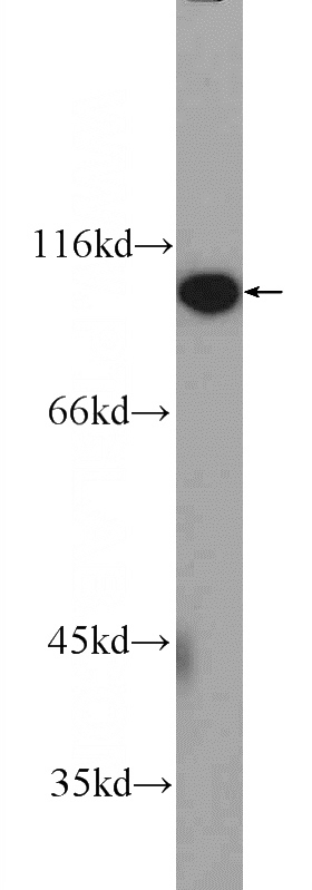 COLO 320 cells were subjected to SDS PAGE followed by western blot with Catalog No:110588(FAM40B Antibody) at dilution of 1:600