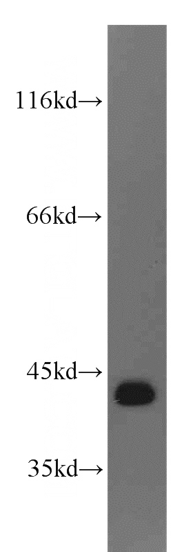 K-562 cells were subjected to SDS PAGE followed by western blot with Catalog No:114856(RTCD1 antibody) at dilution of 1:500
