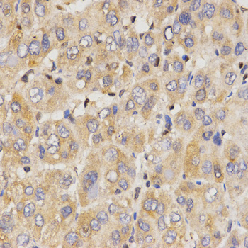 Immunohistochemistry - Eif2ak2 Polyclonal Antibody 
