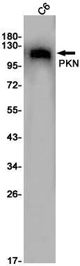 Western blot detection of PKN in C6 cell lysates using PKN Rabbit pAb(1:1000 diluted).Predicted band size:104KDa.Observed band size:120KDa.