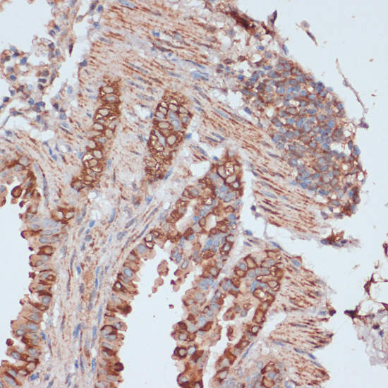 Immunohistochemistry - ACAT1 Polyclonal Antibody 