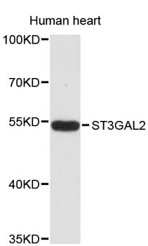 Western blot - ST3GAL2 Polyclonal Antibody 