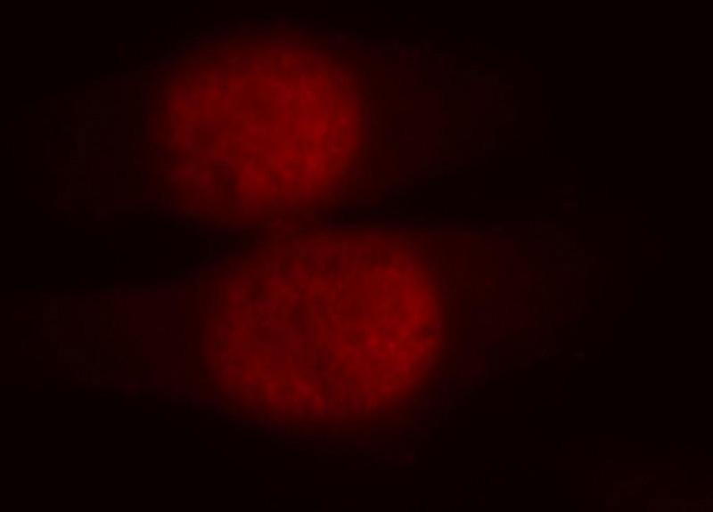 Immunofluorescent analysis of HepG2 cells, using UBR2 antibody Catalog No:116663 at 1:25 dilution and Rhodamine-labeled goat anti-rabbit IgG (red).