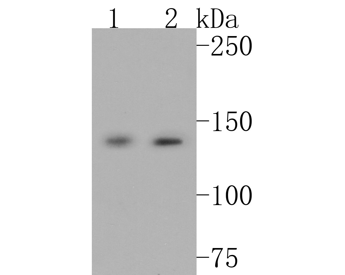 Fig1:; Western blot analysis of Leptin Receptor on different lysates. Proteins were transferred to a PVDF membrane and blocked with 5% BSA in PBS for 1 hour at room temperature. The primary antibody ( 1/500) was used in 5% BSA at room temperature for 2 hours. Goat Anti-Rabbit IgG - HRP Secondary Antibody (HA1001) at 1:200,000 dilution was used for 1 hour at room temperature.; Positive control:; Lane 1: Mouse lung tissue lysate; Lane 2: Mouse liver tissue lysate