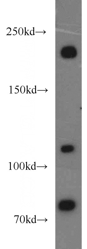 A549 cells were subjected to SDS PAGE followed by western blot with Catalog No:113966(PLXNB2 antibody) at dilution of 1:800