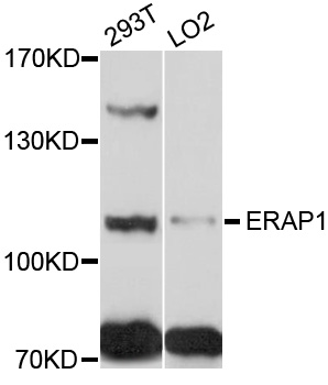 Western blot - ERAP1 Polyclonal Antibody 