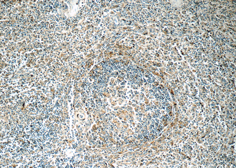 Immunohistochemistry of paraffin-embedded human spleen tissue slide using Catalog No:109043(CD11c/Integrin alpha X Antibody) at dilution of 1:50 (under 10x lens)