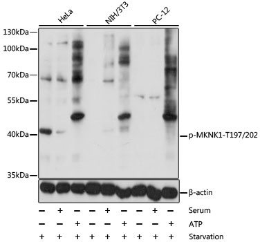 Western blot - Phospho-MKNK1-T197/202 pAb 
