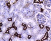 Fig7:; Immunohistochemical analysis of paraffin-embedded mouse kidney tissue using anti-PPP1R1A antibody. The section was pre-treated using heat mediated antigen retrieval with Tris-EDTA buffer (pH 9.0) for 20 minutes.The tissues were blocked in 1% BSA for 30 minutes at room temperature, washed with ddH; 2; O and PBS, and then probed with the primary antibody ( 1/50) for 30 minutes at room temperature. The detection was performed using an HRP conjugated compact polymer system. DAB was used as the chromogen. Tissues were counterstained with hematoxylin and mounted with DPX.
