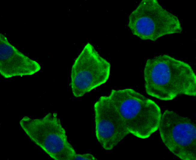 Fig2: ICC staining Nesprin 1 in A549 cells (green). The nuclear counter stain is DAPI (blue). Cells were fixed in paraformaldehyde, permeabilised with 0.25% Triton X100/PBS.