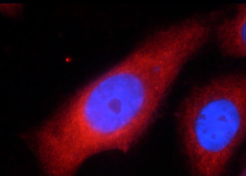Immunofluorescent analysis of HepG2 cells using Catalog No:116625(UPF1 Antibody) at dilution of 1:50 and Rhodamine-labeled goat anti-rabbit IgG (red).