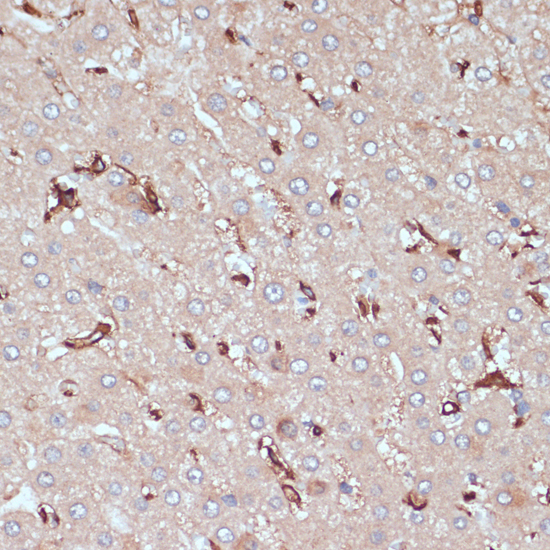 Immunohistochemistry - HLA-DRA Polyclonal Antibody 