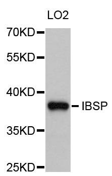 Western blot - IBSP Polyclonal Antibody 