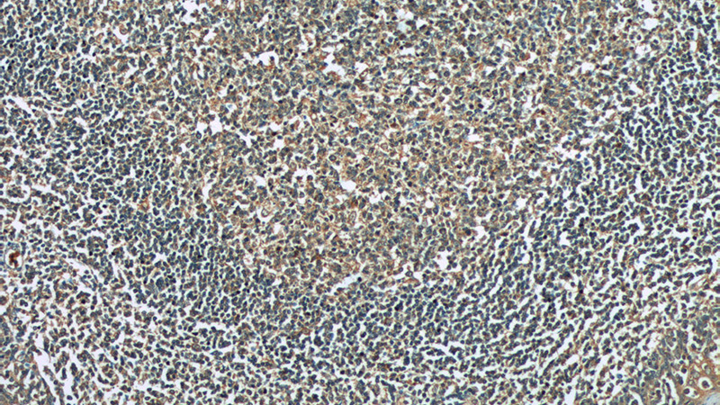 Immunohistochemistry of paraffin-embedded human tonsillitis tissue slide using Catalog No:114343(PVRIG Antibody) at dilution of 1:50 (under 10x lens)